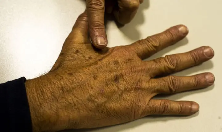 Brasil terá 704 mil novos casos de câncer por ano até 2025, diz Inca