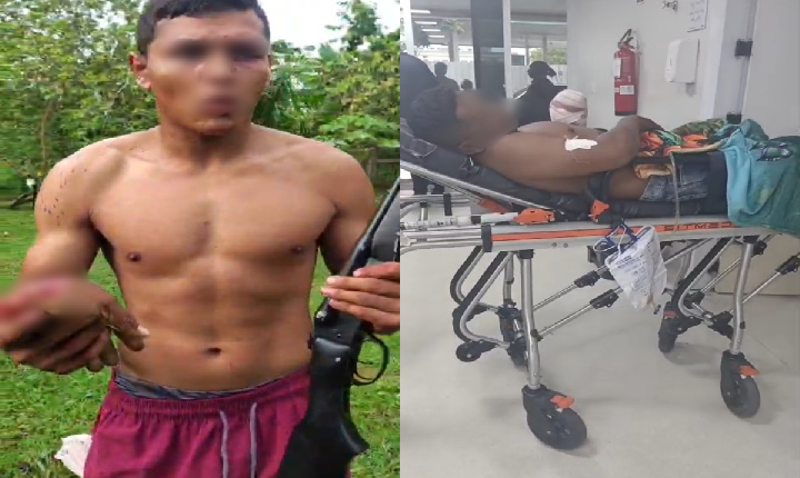 BRIGA ENTRE VIZINHOS TERMINA COM MÃO DECEPADA E HOMEM BALEADO EM COMUNIDADE DO INTERIOR