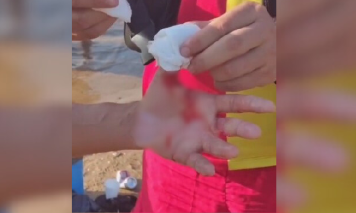 (Vídeo): Banhistas são atacados por piranhas no Amazonas