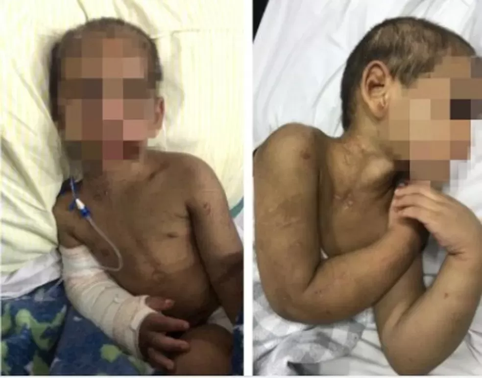 Padrasto que espancou criança junto com mãe é morto em SP