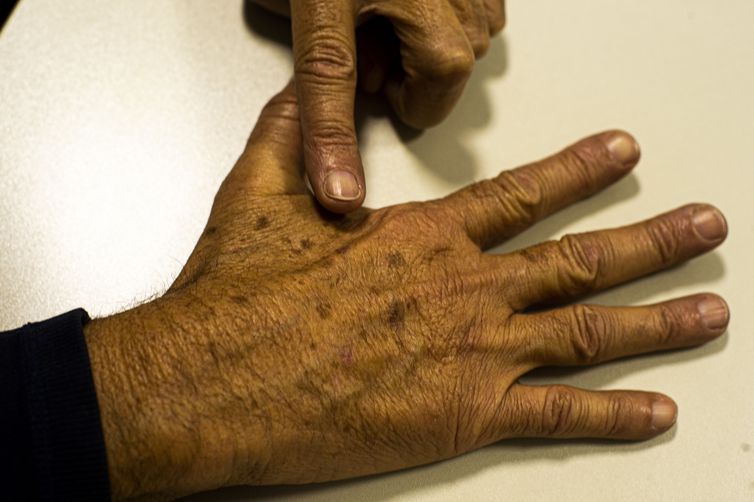 Brasil terá 704 mil novos casos de câncer por ano até 2025, diz Inca