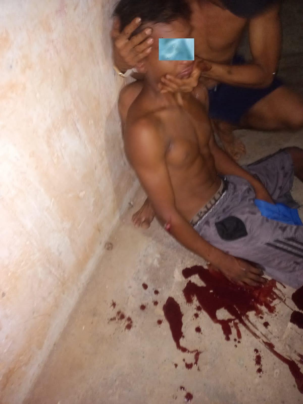 Fonte Boa: Homem quase foi assassinado a golpes de arma branca no Bairro Pai Sabá