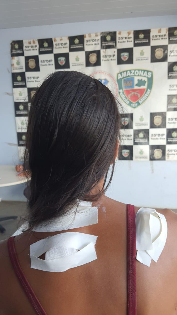 Fonte Boa: Mulher quase foi assassinada com várias perfurações de faca pelas costas