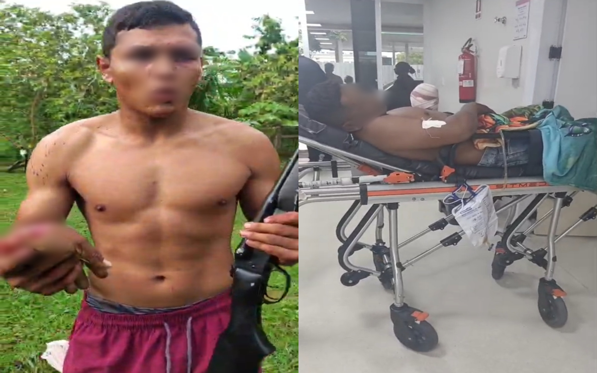 BRIGA ENTRE VIZINHOS TERMINA COM MÃO DECEPADA E HOMEM BALEADO EM COMUNIDADE DO INTERIOR