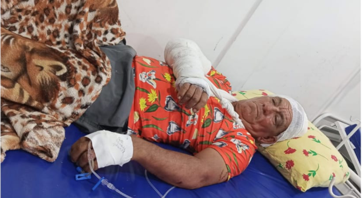 Roubo com agressão: Morador é brutalmente espancado em Fonte Boa e caso termina com 4 suspeitos presos