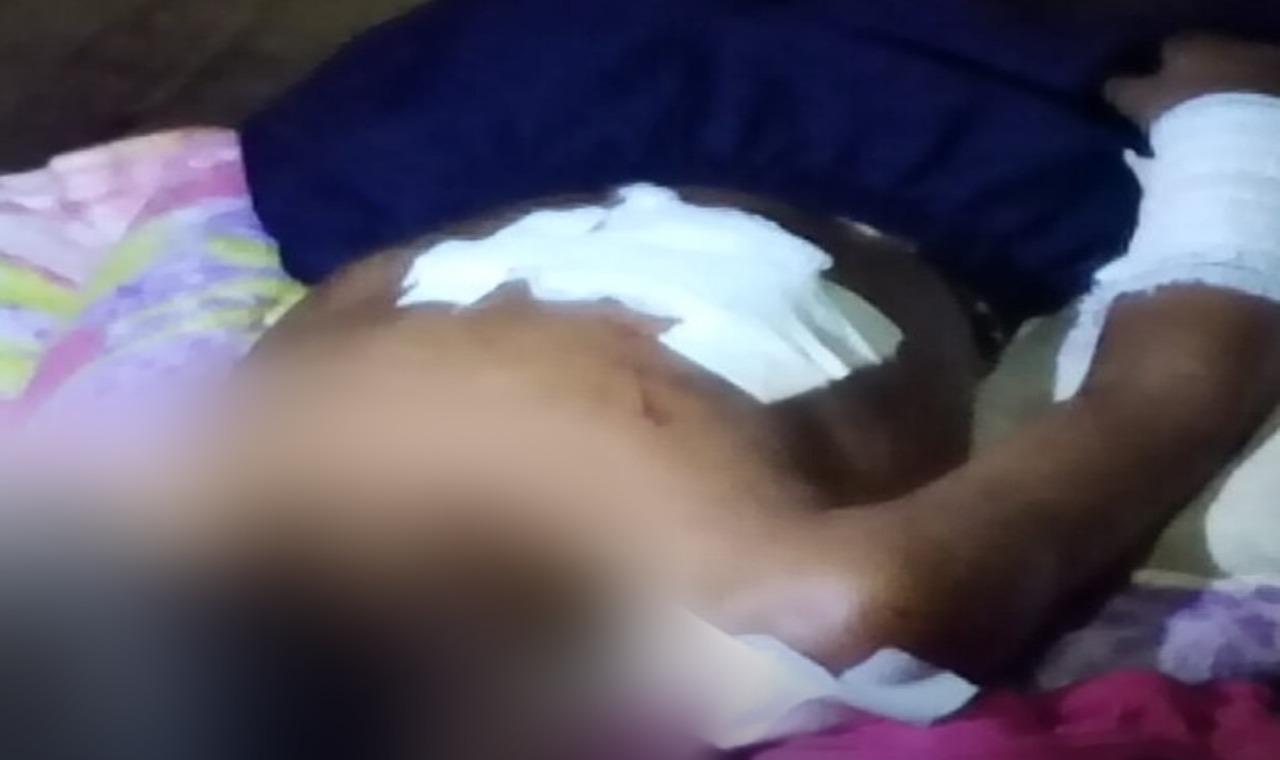 Tio salva criança de ataque de jacaré durante pescaria em Fonte Boa